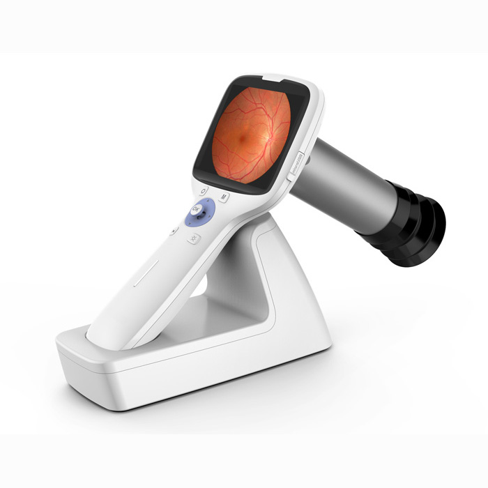 NES-1000-Portable-Fundus-Camera