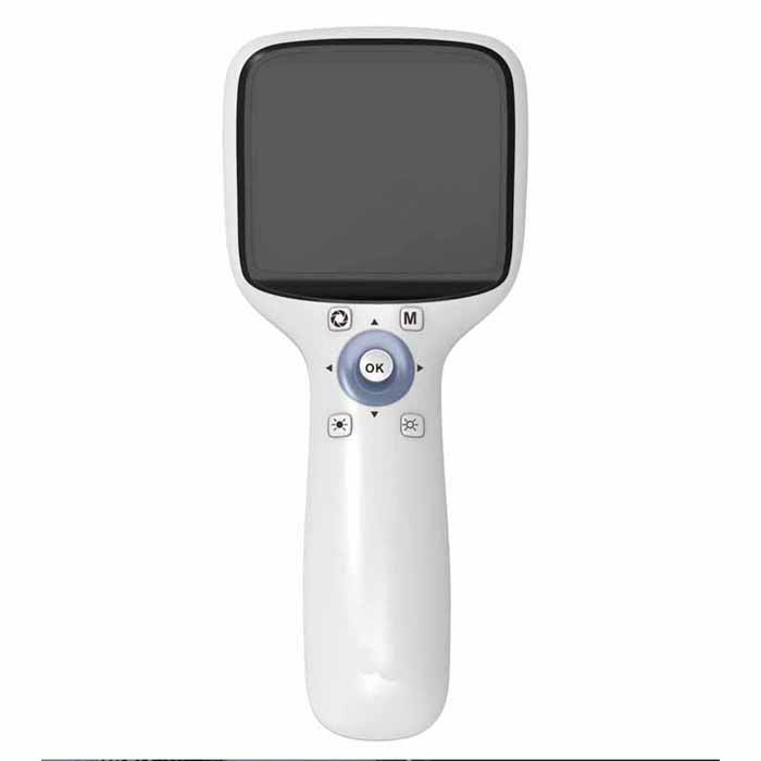 NES-1000-Portable-Fundus-Camera