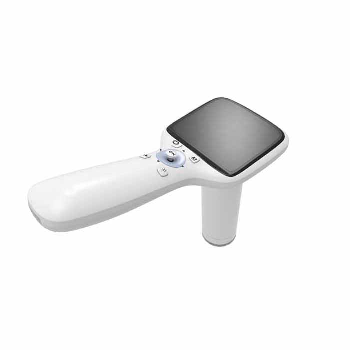 NES-1000-Portable-Fundus-Camera