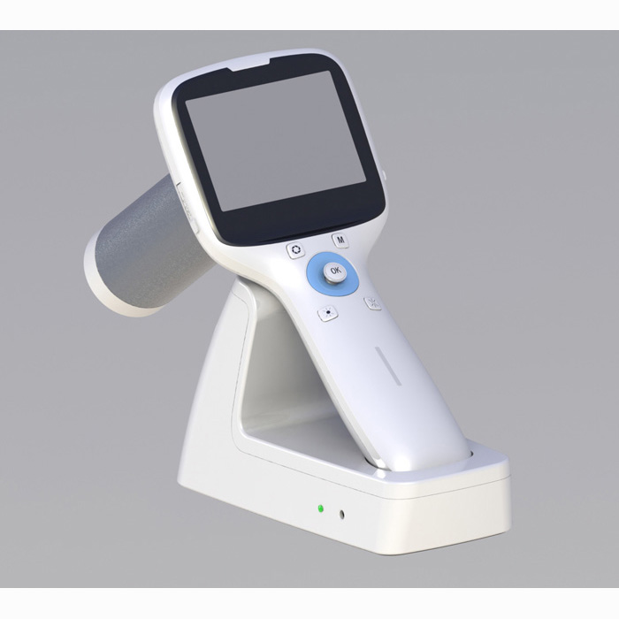 NES-1000-Portable-Fundus-Camera