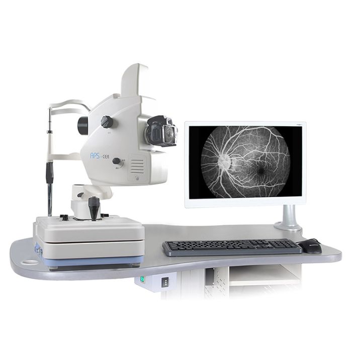 APS-B Fundus Camera & FFA | Nikon D5300 | 24.1MP, Auto Mode, Dicom 3.0 Interface
