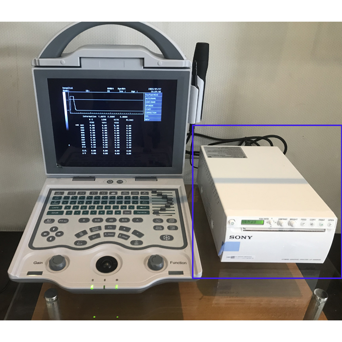 ODU5 Ophthalmic Ultrasound A/B Scanner - video preview