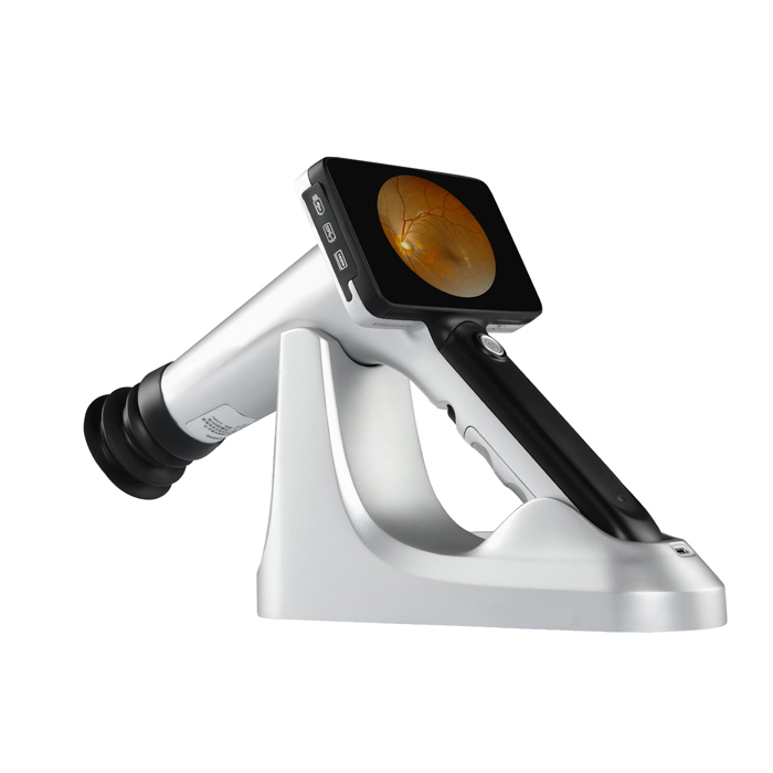 PFC-11 Luna Plus Portable Fundus Camera - video preview